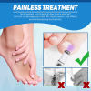 Hot Nail Fungal Pen Anti Fungus Blue Light Laser Pen Onychomycosis Painless Nail Repair Pen Nail Care Repair Serum